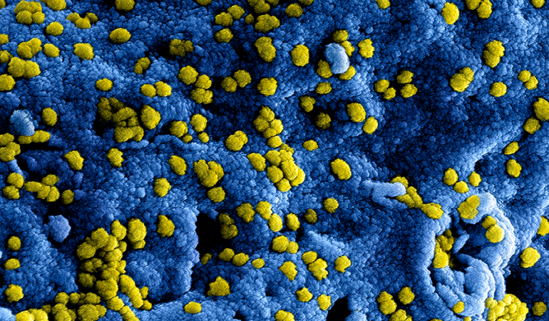 Protocol coronavirus